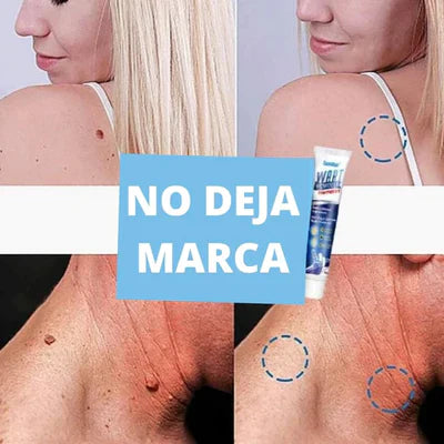 Wartsprotec® Tratamiento para pecas, manchas y Verrugas