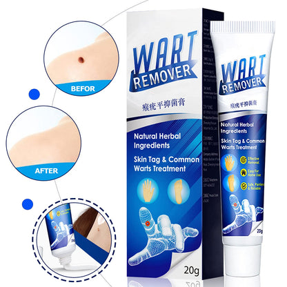 Wartsprotec® Tratamiento para pecas, manchas y Verrugas