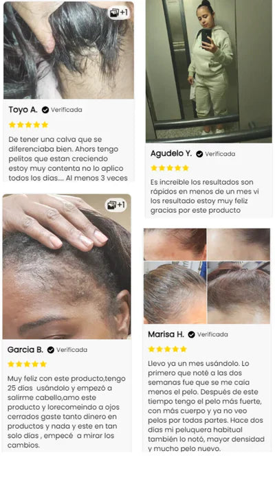 Vitaorganic crecimiento del cabello en 15 días😍🔥LLEVA EL 2DO CON UN 50% DE DESCUENTO🔥🔥